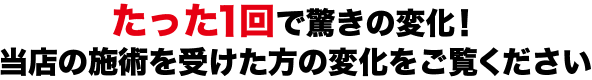 たった1回で驚きの変化!当店の施術を受けた方の変化をご覧ください